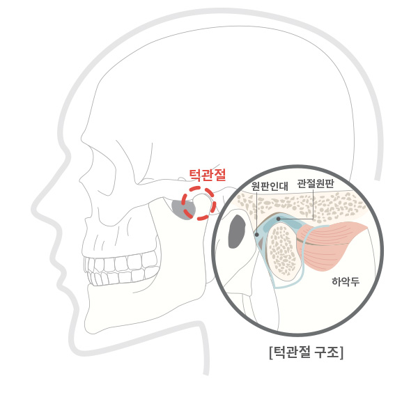 턱관절 치료 | 서울턱구강내과치과의원